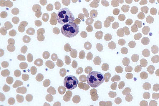 Red blood cells and purple neutrophils, a type of immune cell