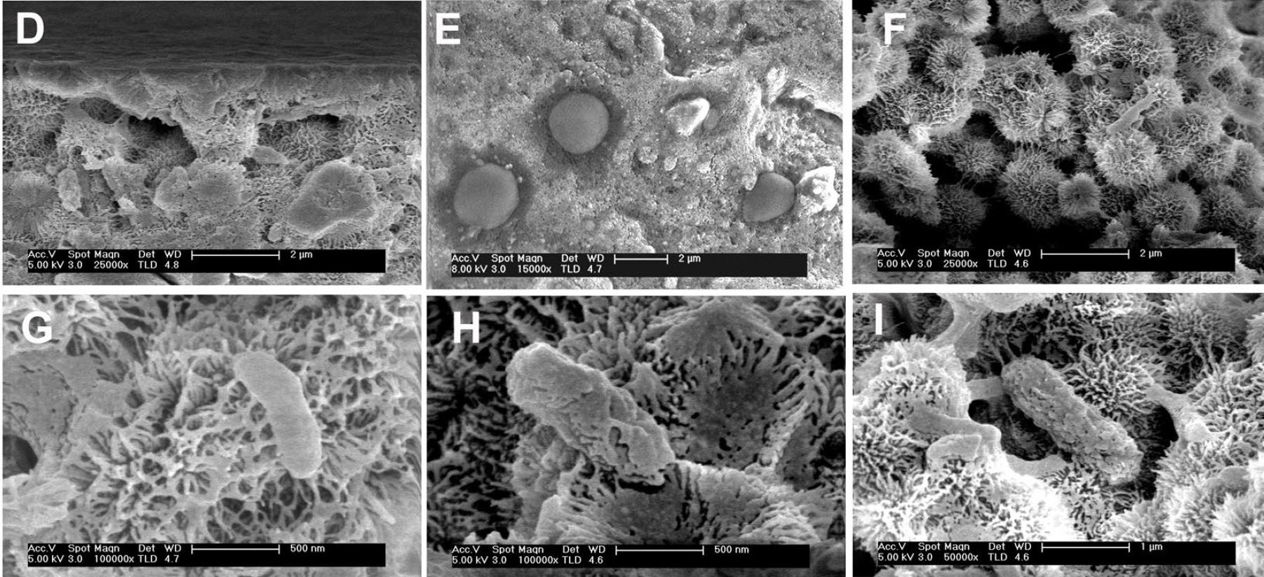 Pill-shaped micro-organisms within a network of thin, needle-like crystals