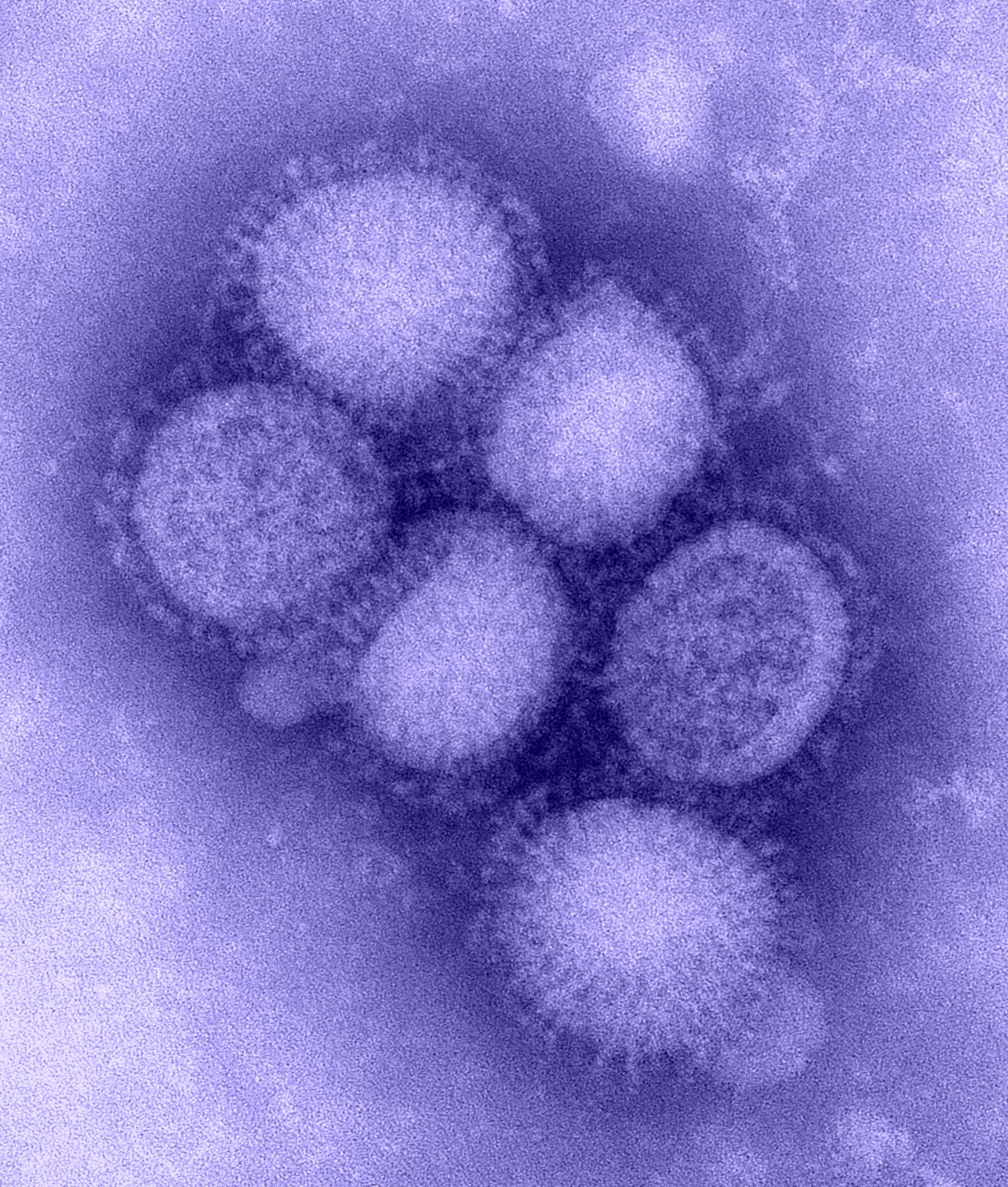 A microscope image of H1N1 influenza virus particles, colored purple.