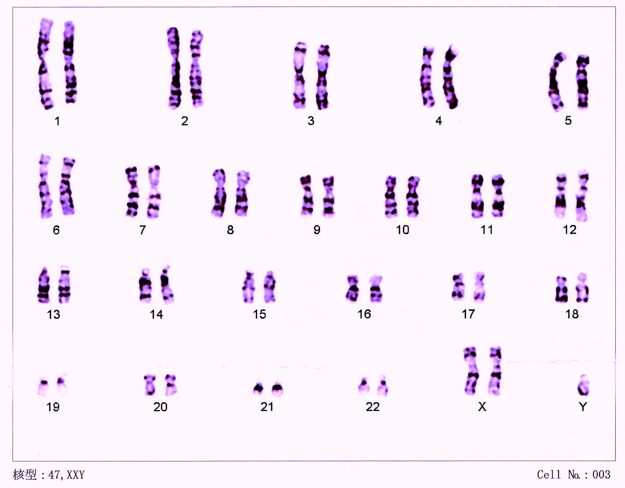 Questions About Biology Sex And Gender We Have Answers