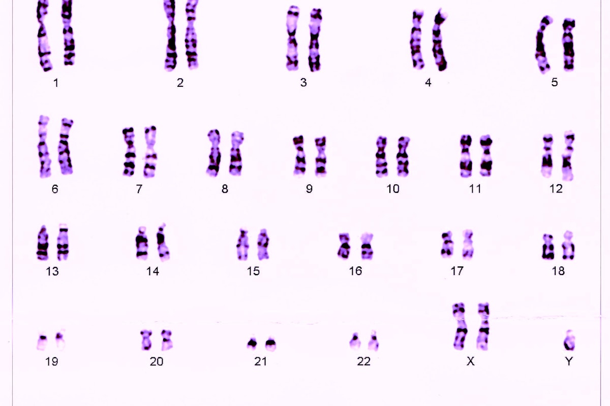 Questions About Biology Sex And Gender We Have Answers