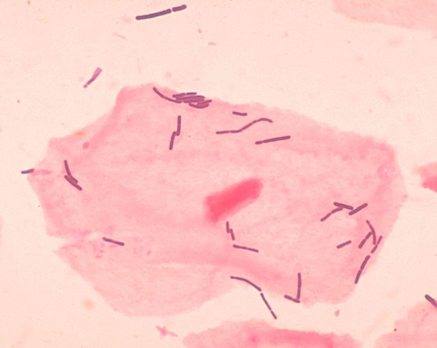 Small Lactobacillus bacteria under a microscope, seen near a skin cell. 