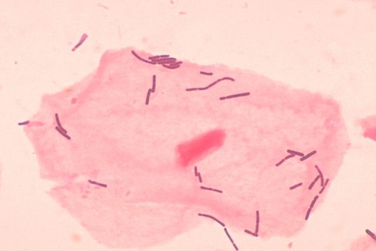 Small Lactobacillus bacteria under a microscope, seen near a skin cell. 