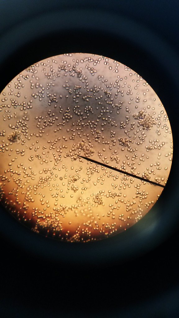 yeast under a microscope