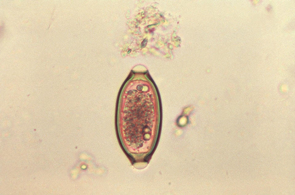 microscope photo of an oblong parasite