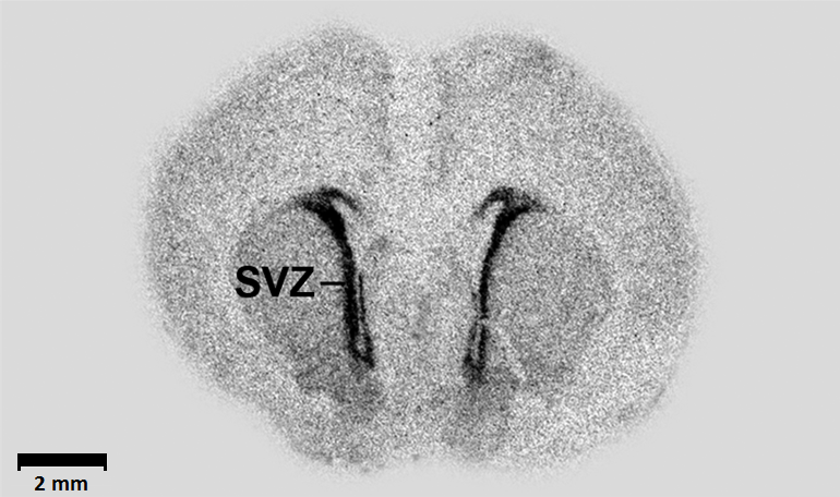 a photo of the brain area called the subventicular zone